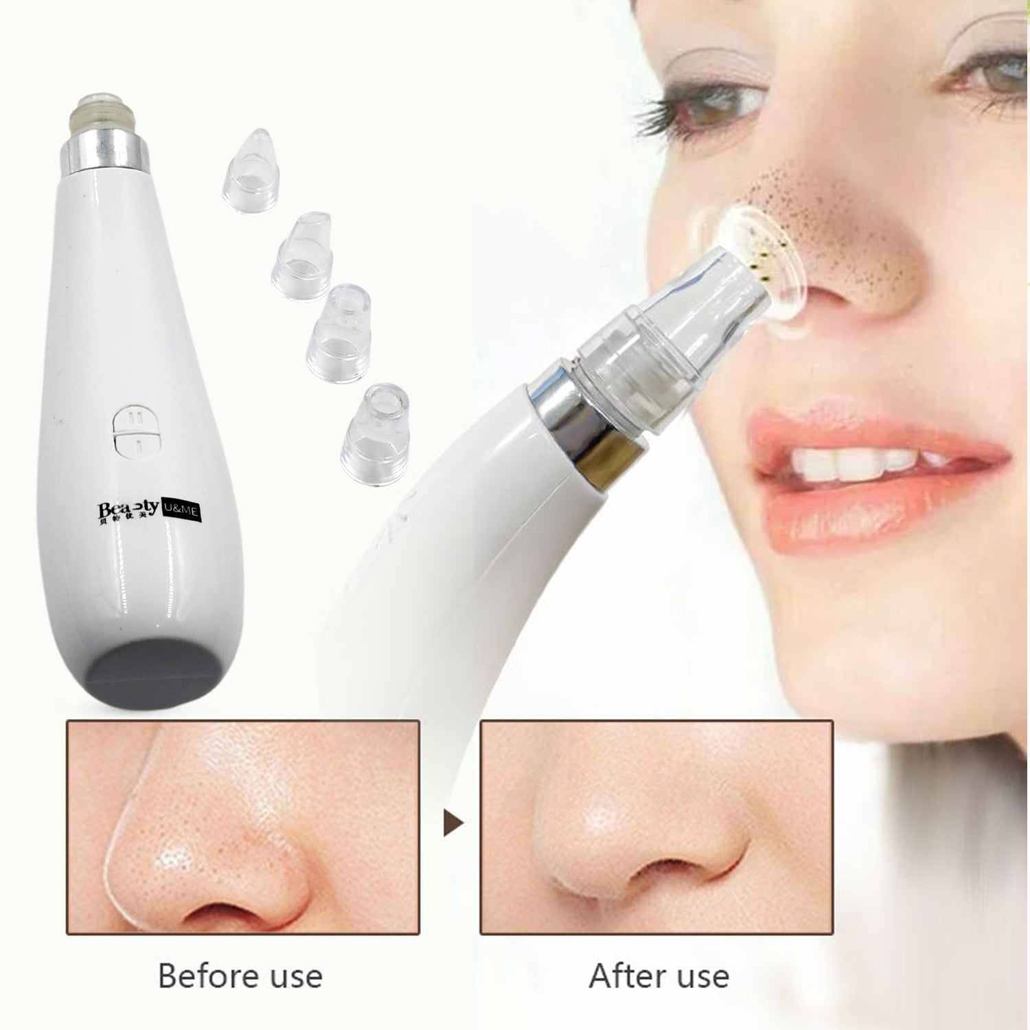 0351A Blackhead Remover Vacuum Suction Facial Pore Cleaner Dermabrasion Face Facial Pore Cleaner, Beauty Device kit with 4 Suction Probes for Women & Men